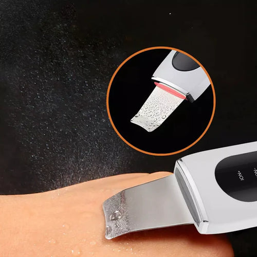 Aparelho de Peeling Sem Cravos e Espinhas - Ultra Sônico Portátil
